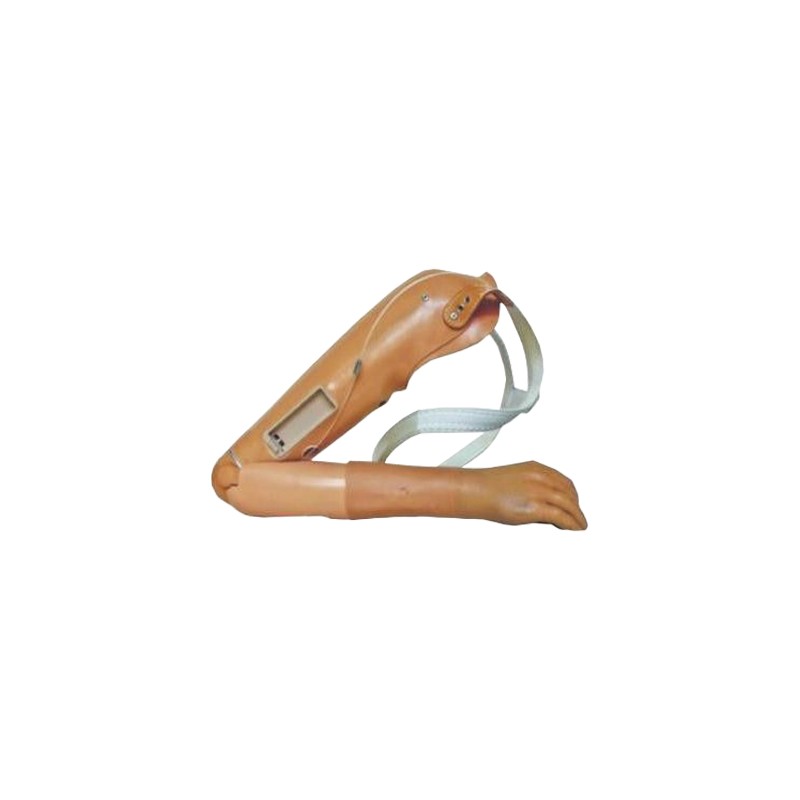 Žastikaulio (virš alkūnės) protezas